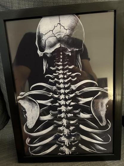 Gerahmte Kunstwerke des Oberkörpers eines menschlichen Skeletts, einschließlich des Schädels und des Brustkorbs, vor einem dunklen Hintergrund.